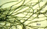 Dettaglio dei filamenti cenocitici